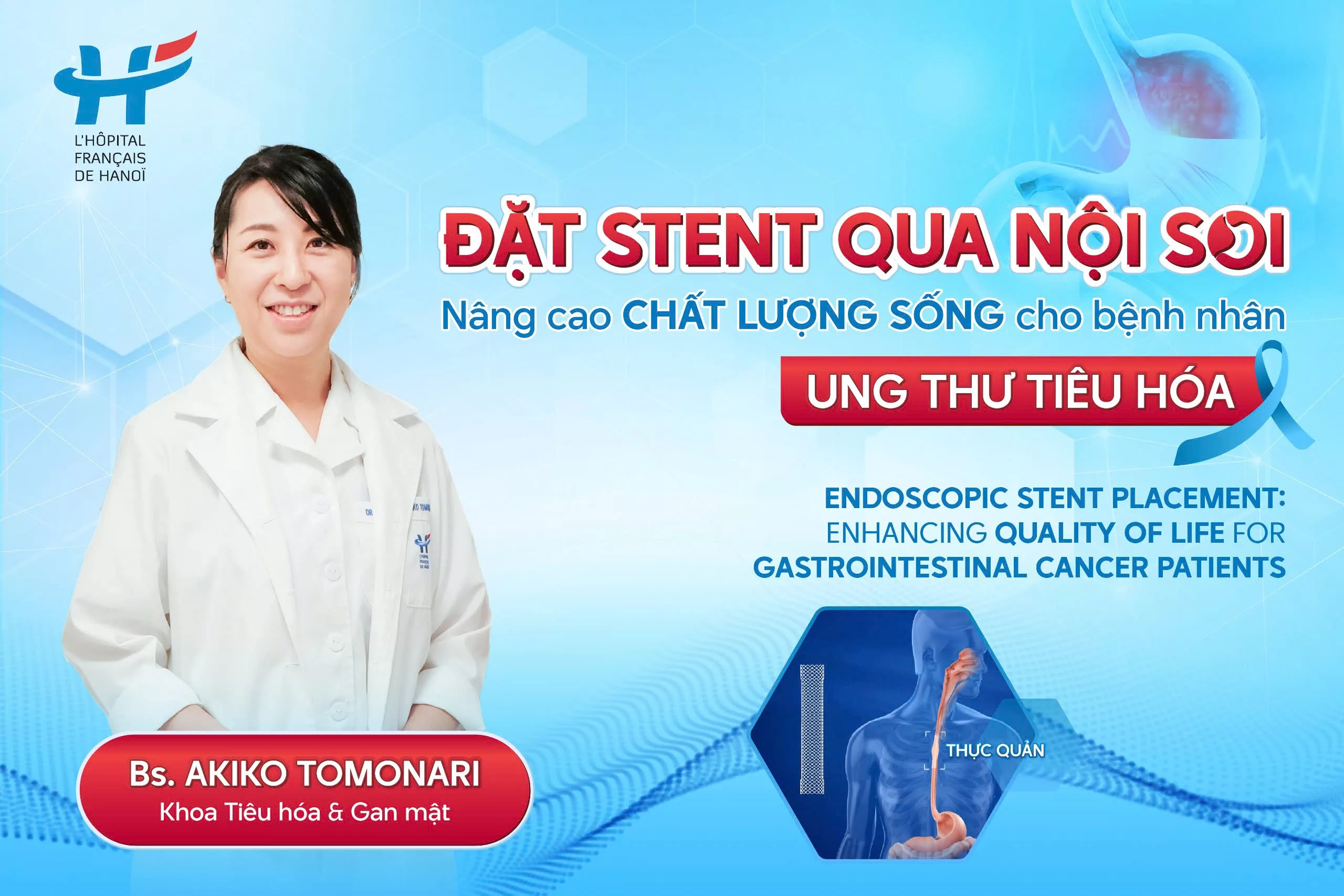 ENDOSCOPIC STENT PLACEMENT: ENHANCING QUALITY OF LIFE FOR GASTROINTESTINAL CANCER PATIENTS